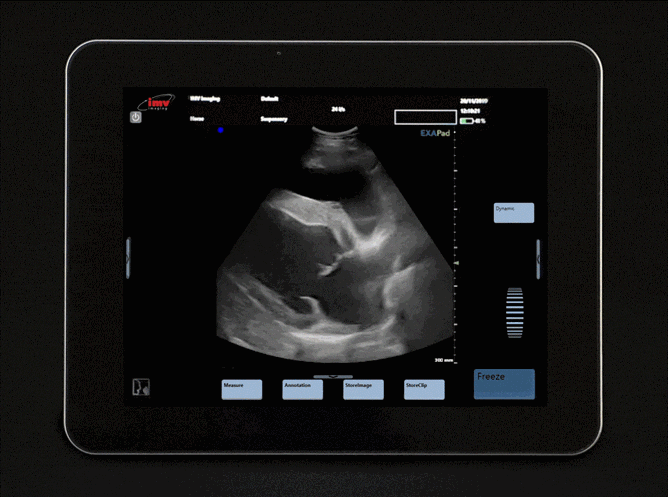 Cardiac scan