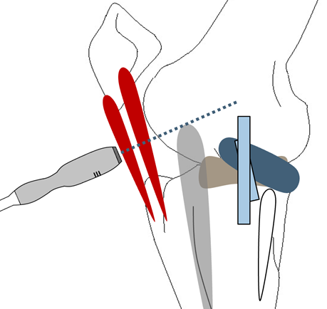 Imaging Stifle Joint